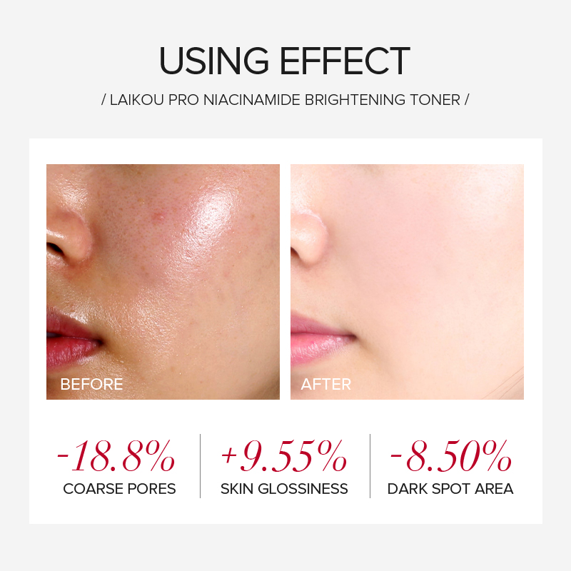 LAIKOU PRO Niacinamid 4-teilig – Skincare Oily Skin Bewertung und Preis