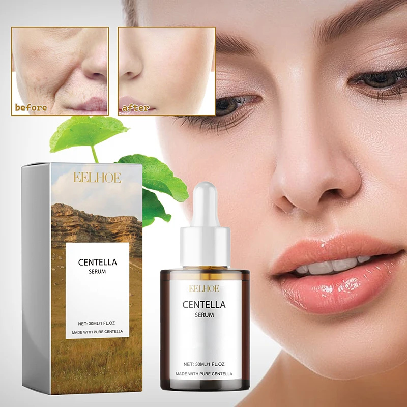 Centella Asiatica Gesichtsseru – Centella Asiatica Toner Bewertung und Preis