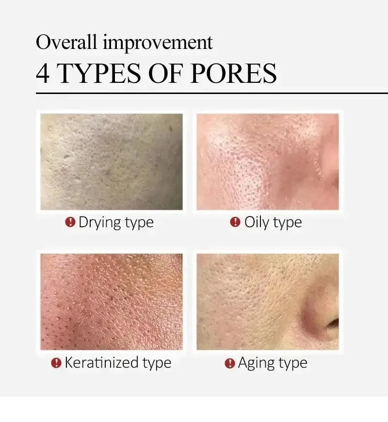 Centella Asiatica Porenverfein – Centella Asiatica Toner Bewertung und Preis